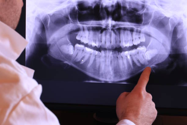 Best Emergency TMJ Treatment in Marin City, CA