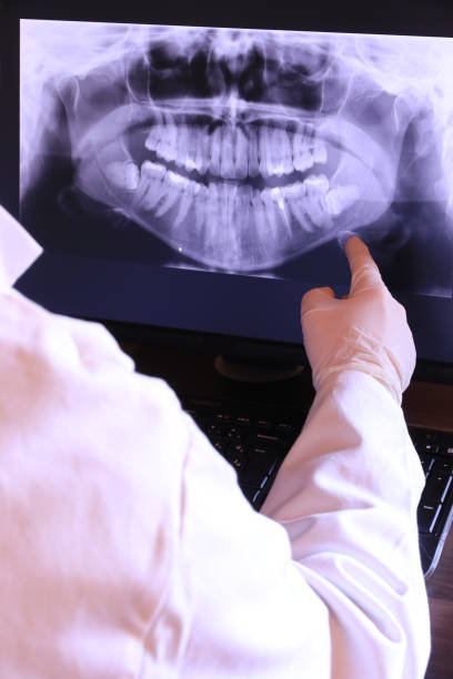 Best Emergency Tooth Extraction in Marin City, CA